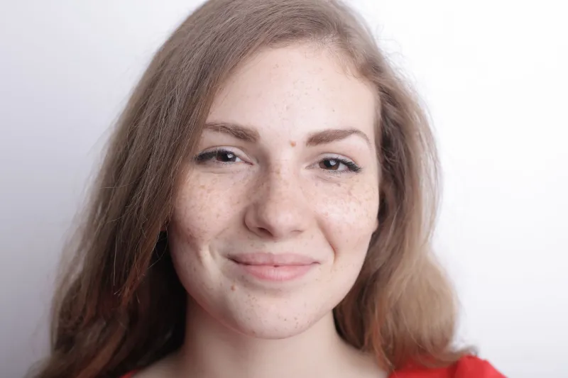 Spot On: Why Your Most Distinctive Features Are Actually Your Greatest Beauty Assets